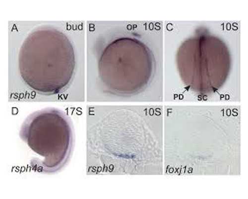 试管养囊费用解析与助孕策略