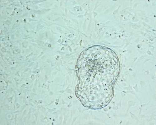 供卵试管助孕机构电话与定制服务指南